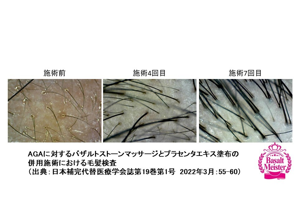 育毛ケアオプション イメージ2